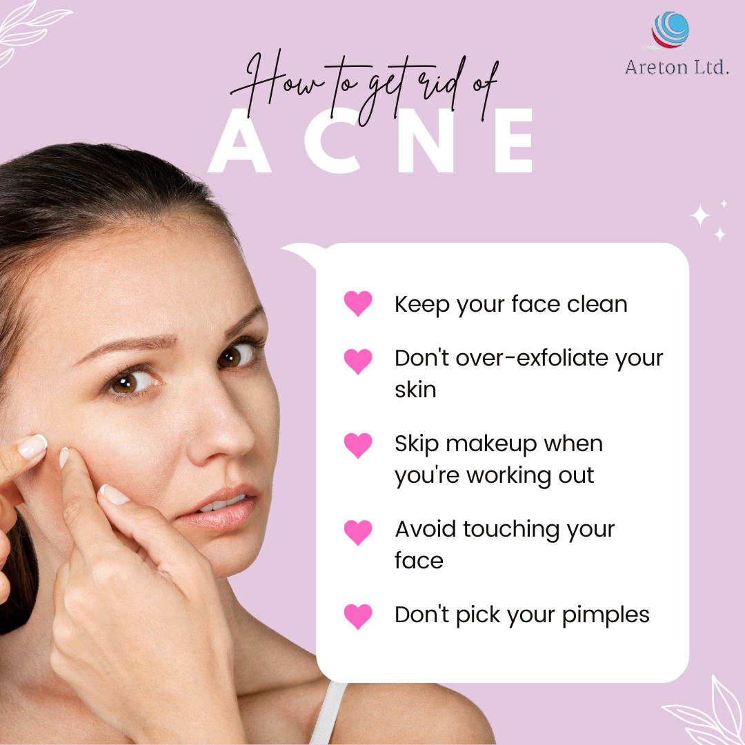 How to get rid of Acne