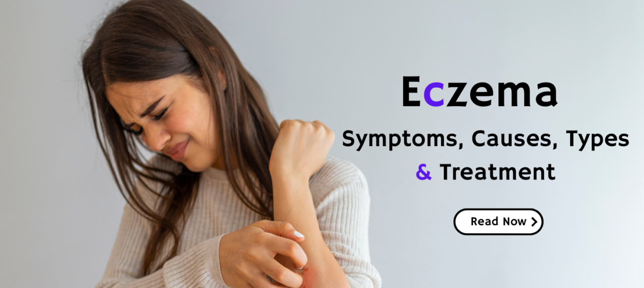 Eczema: What It Is, Symptoms, Causes, Types & Treatment